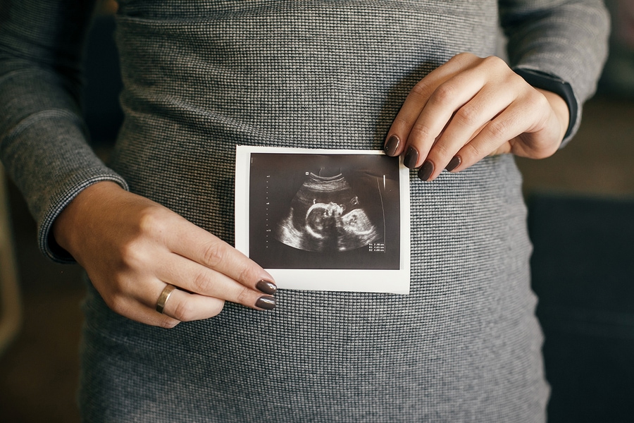 Pregnant Woman Holding Ultrasound Scan Of Her Baby
